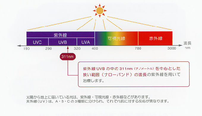 ナローバンドＵＶＢ