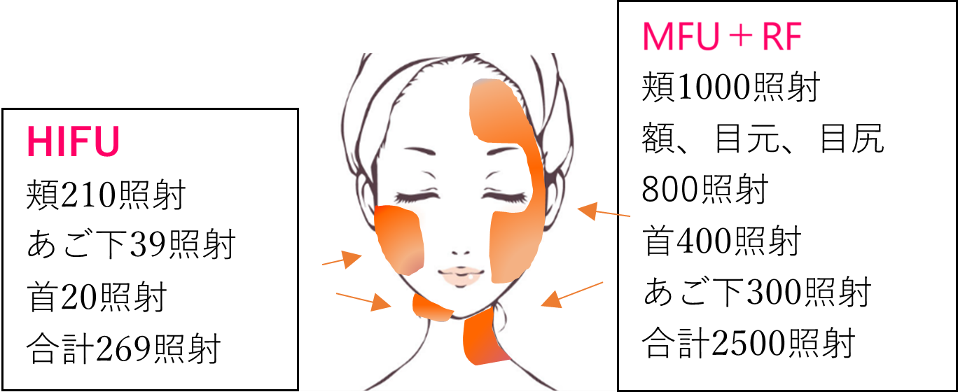 おすすめコースC おすすめコースC