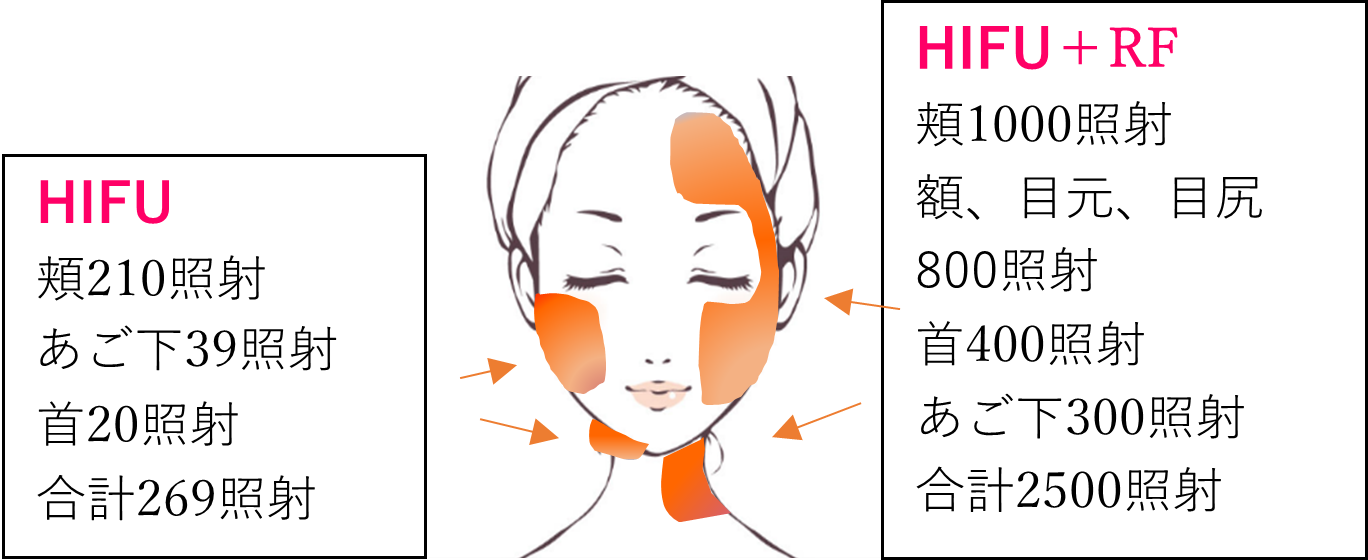 おすすめコースC おすすめコースC