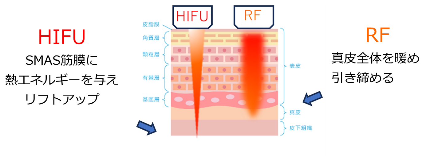 HIFURF効果